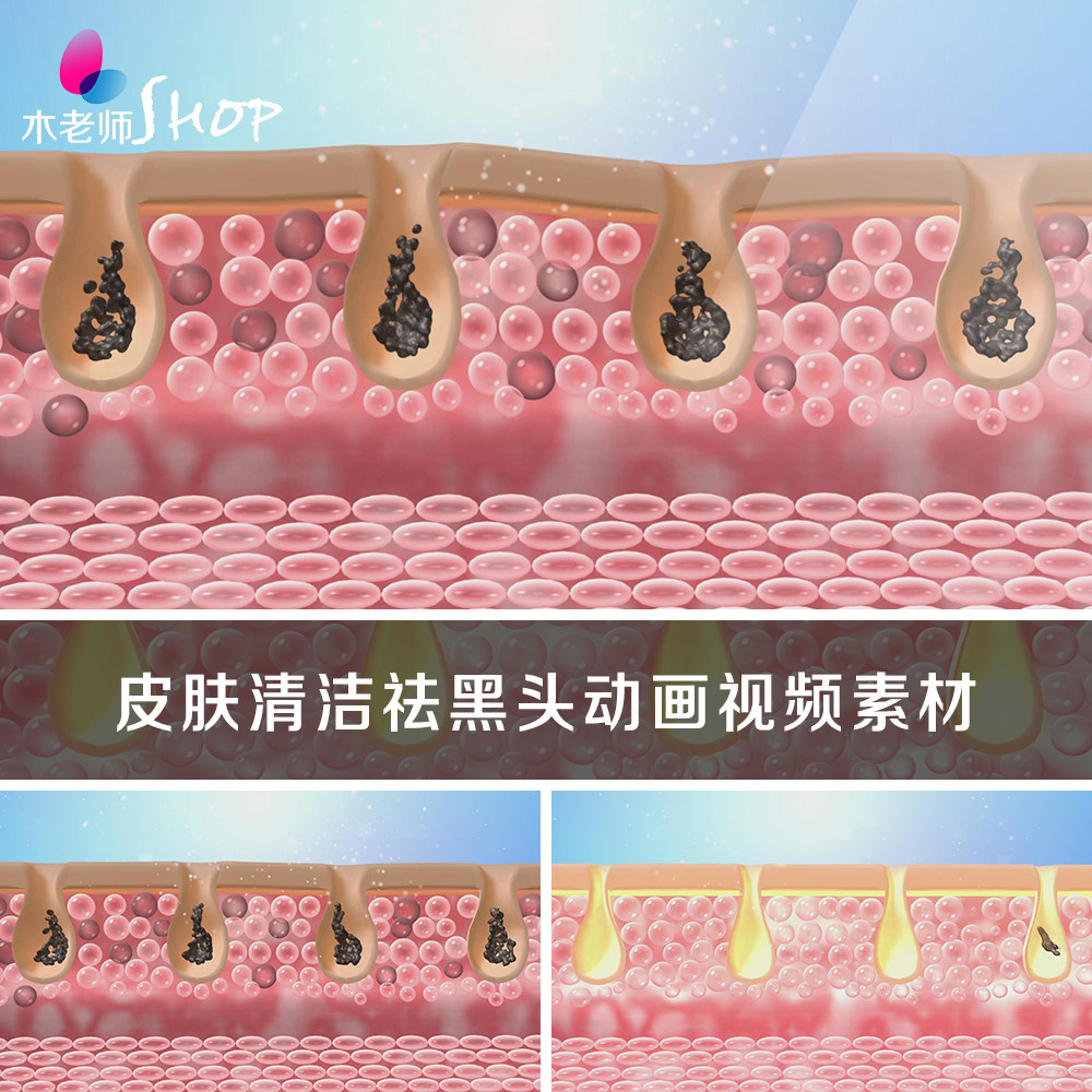皮肤清洁祛除黑头动画视频粉刺毛孔清理美容护肤洁面保养广告素材