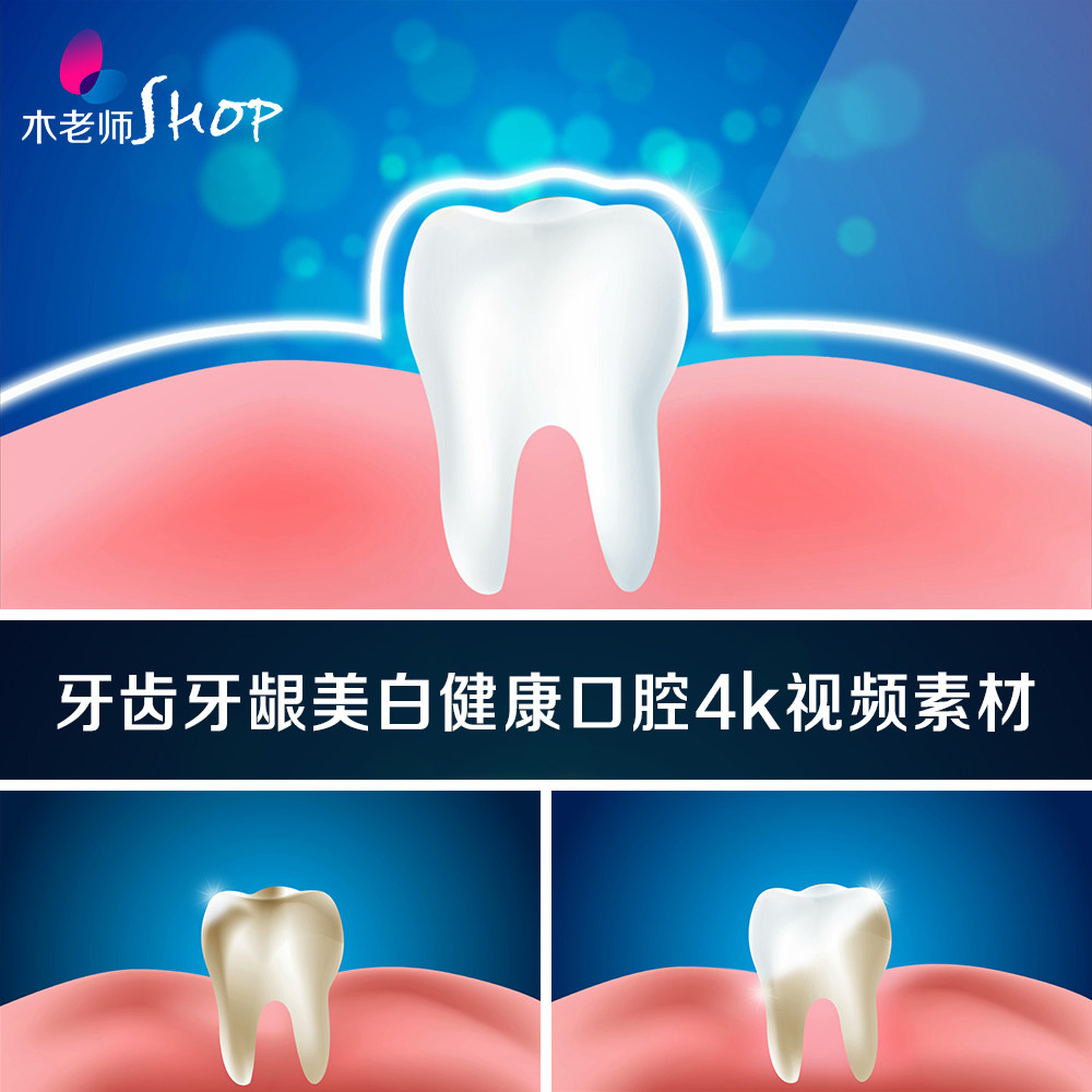动画牙齿和牙龈美白健康口腔4k视频素材牙科整形洁牙洗牙超清视频