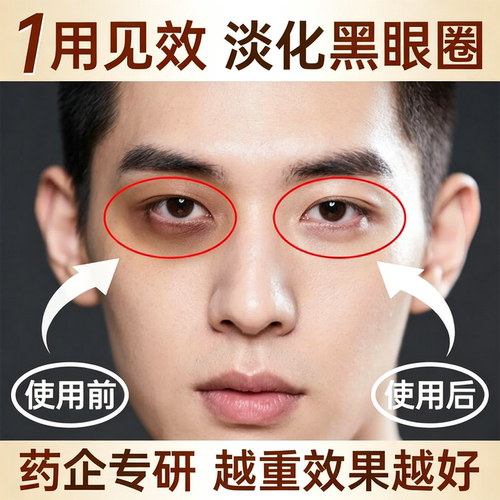 男士专用淡化黑眼圈眼霜药企专研