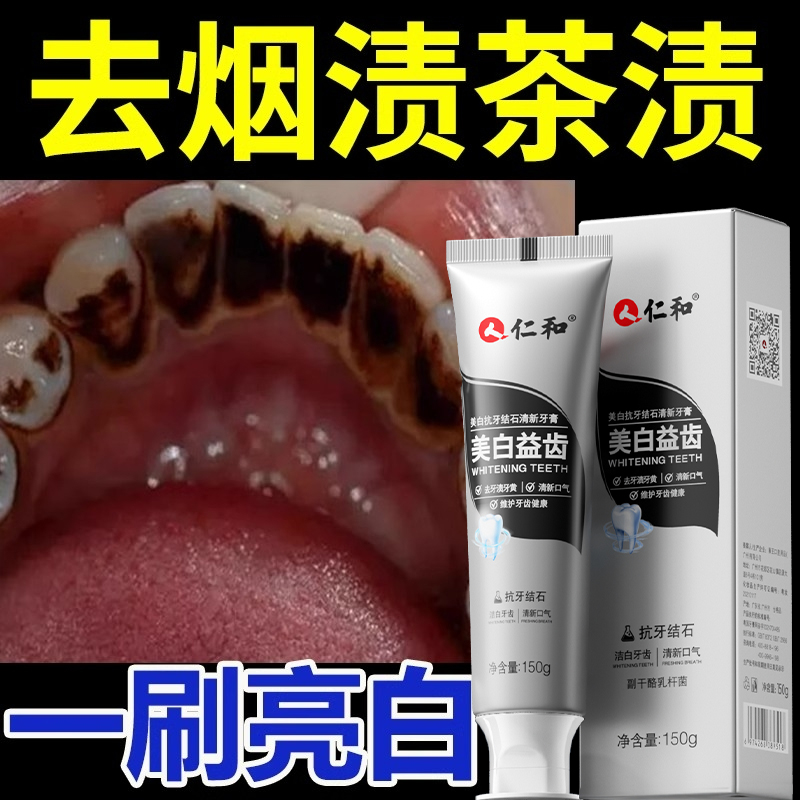 匠心仁和去烟渍牙膏美白去黄去口臭官方旗舰店正品排行榜第一名