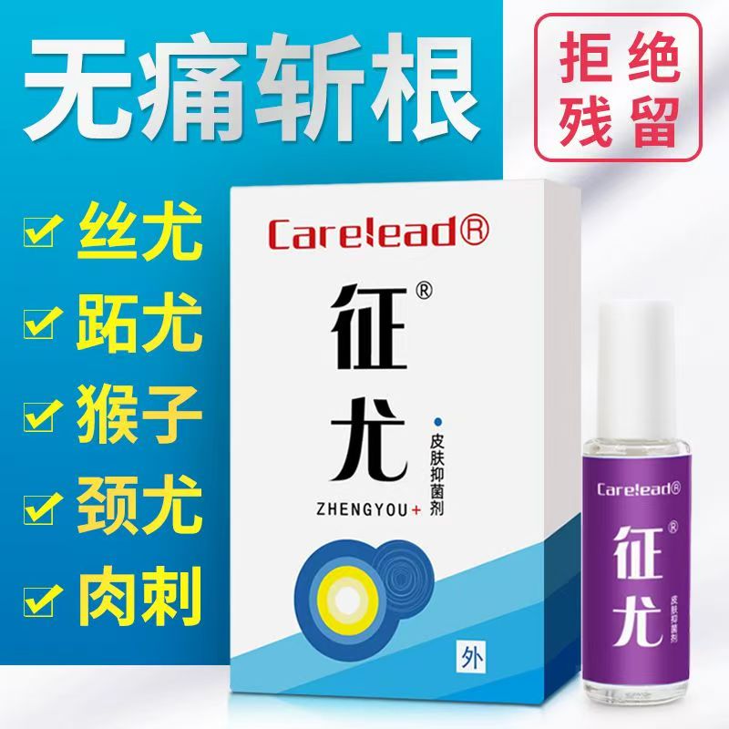 征尤寻常跖鱼鳞痣血胞刺血泡刺贴脚底手指足部非去除专用膏贴根祛