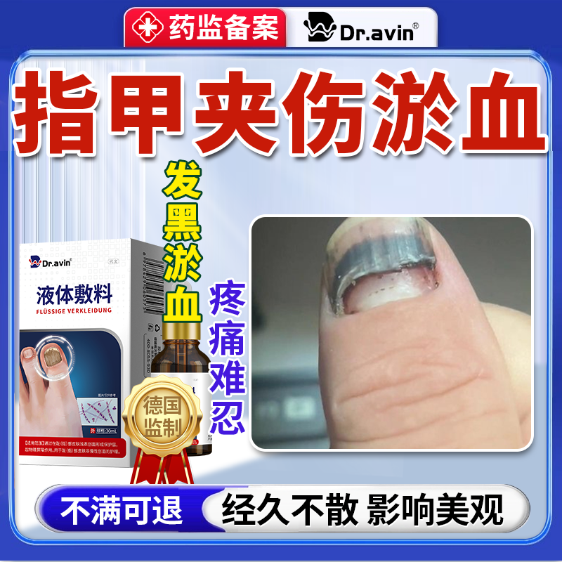 手脚指甲盖下淤血出血被砸压夹受伤去淤血修复液受损液体敷料VT