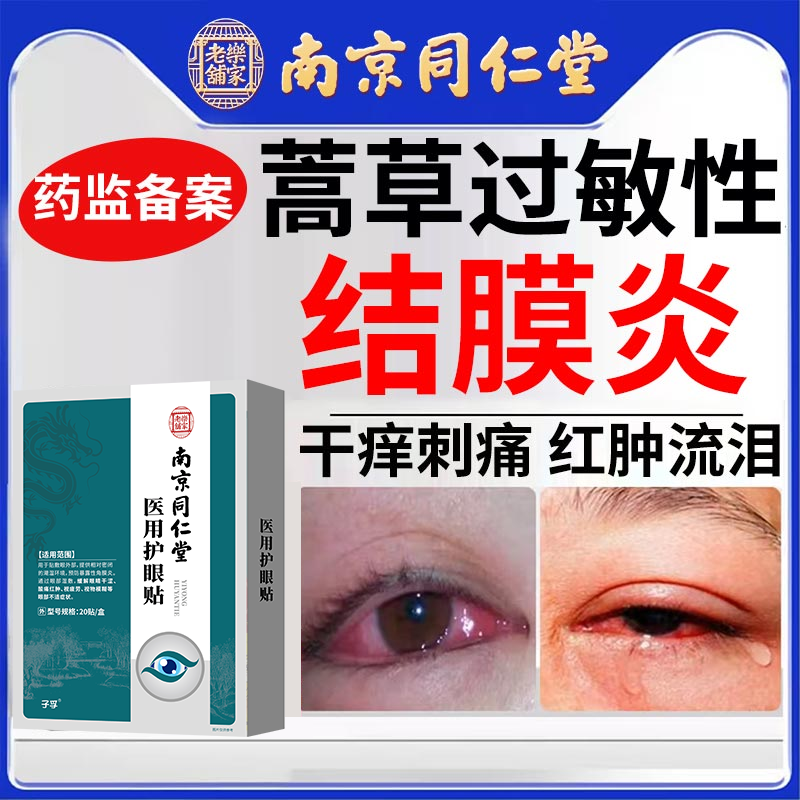 螨虫过敏性结膜炎角膜炎冷敷贴过敏性鼻炎眼睛痒搭滴眼液洗眼液PG