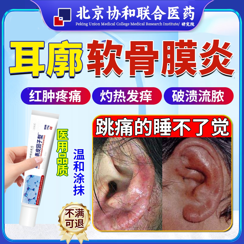 耳廓软骨膜炎化脓性发热疼痛发红肿胀灼热流黄水灼热感破溃流脓pg
