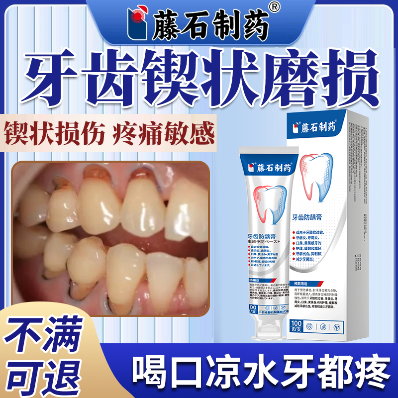 牙齿锲状磨损凝胶牙龈牙根牙釉质腐蚀松动敏感酸痛脱敏口腔疼痛VT