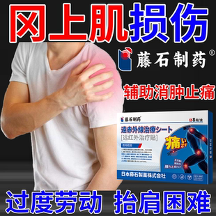 冈上肌肌腱损伤拉伤肩膀疼痛酸胀僵硬肩袖撕裂热敷膏贴PG