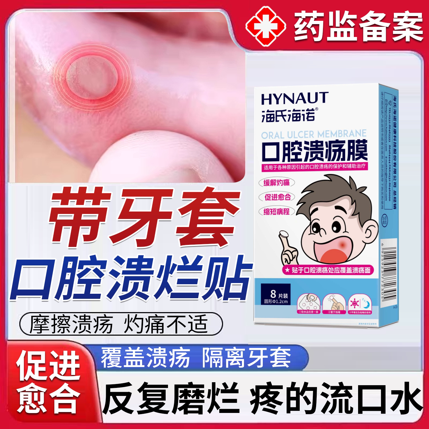 正畸口腔溃疡贴片防磨嘴