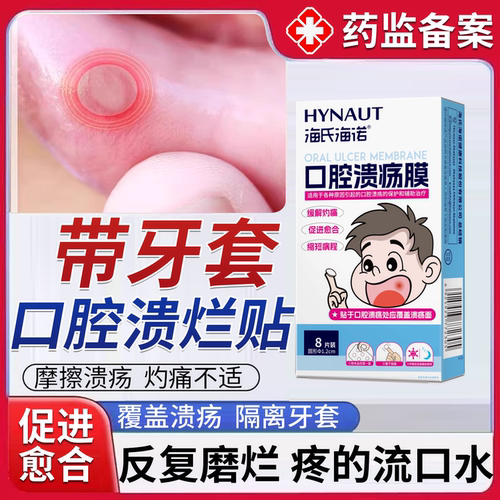 正畸口腔溃疡贴片防磨嘴