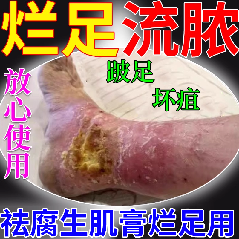 专注糖尿病烂足烂腿快速愈合长肉