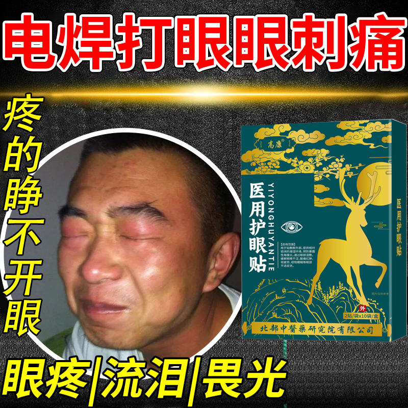 烧电焊焊工打眼睛医用冷敷退热贴护眼刺眼红肿痛畏光流泪痒PG