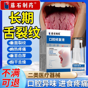 舌裂纹反复型舌炎舌苔白厚腻舌头裂纹有齿痕舌头上火溃疡喷雾剂PG