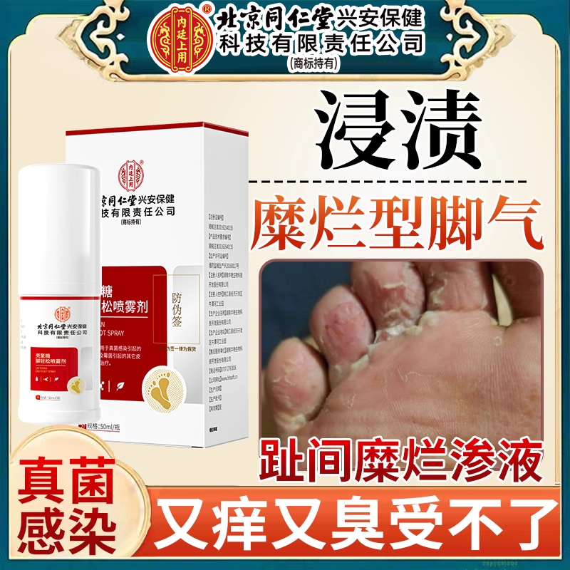 浸渍糜烂型脚气足癣真菌感染脚趾间缝烂痒脚痒水泡烂脚丫喷剂PG