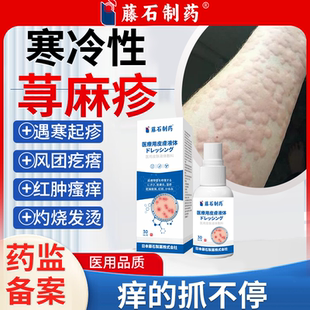受冷寒冷性荨麻疹过敏止痒专喷雾剂外用免疫力低药监备案PG