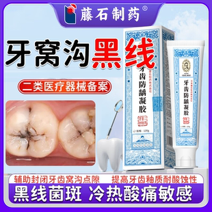 牙齿防蛀牙龋齿去黑线牙黑线黑渍牙窝沟清洁牙齿酸痛敏感PG