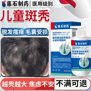 儿童斑秃药监备案膏生发液特鬼剃头贴效遮盖神专器用脱发瘙痒PG