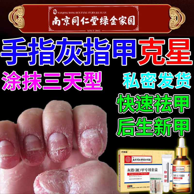 南京同仁堂灰指甲抑菌液灰指甲神器同仁堂灰指甲专用套盒js使用感如何?
