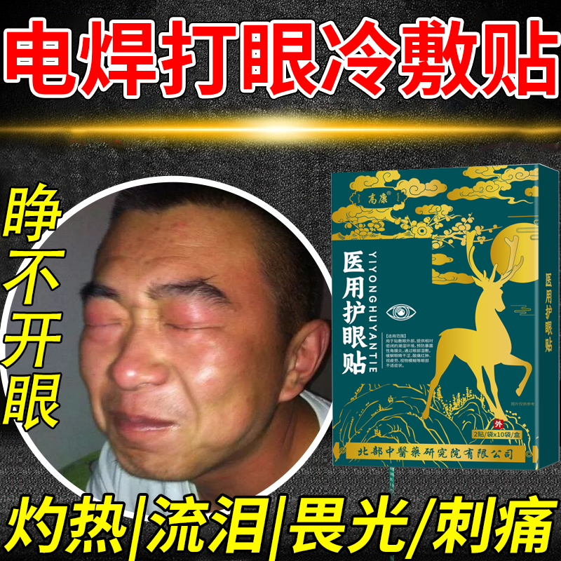 烧电焊焊工打眼睛医用冷敷退热贴护眼刺眼红肿痛畏光流泪痒PG