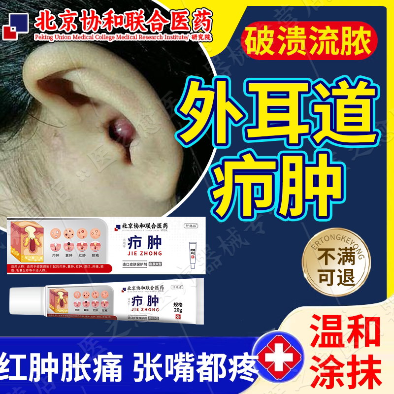 外耳道疖肿硬块耳朵长痘痘脓包拔毒拔脓膏皮脂腺囊肿破溃疼流脓pg
