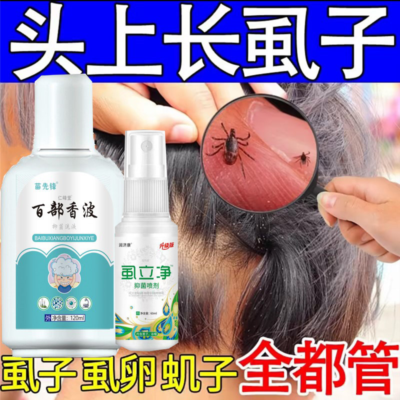 去头虱子儿童虱立净去除虱卵小女皮肤消毒护理（消）