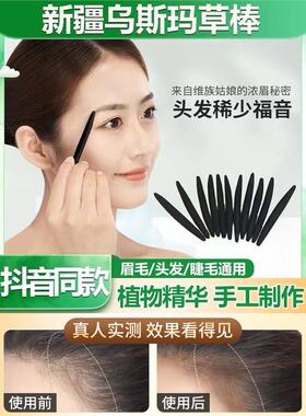 高档【毛发稀少福音！】