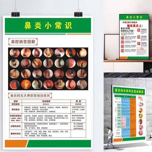鼻炎科普知识海报医院展板