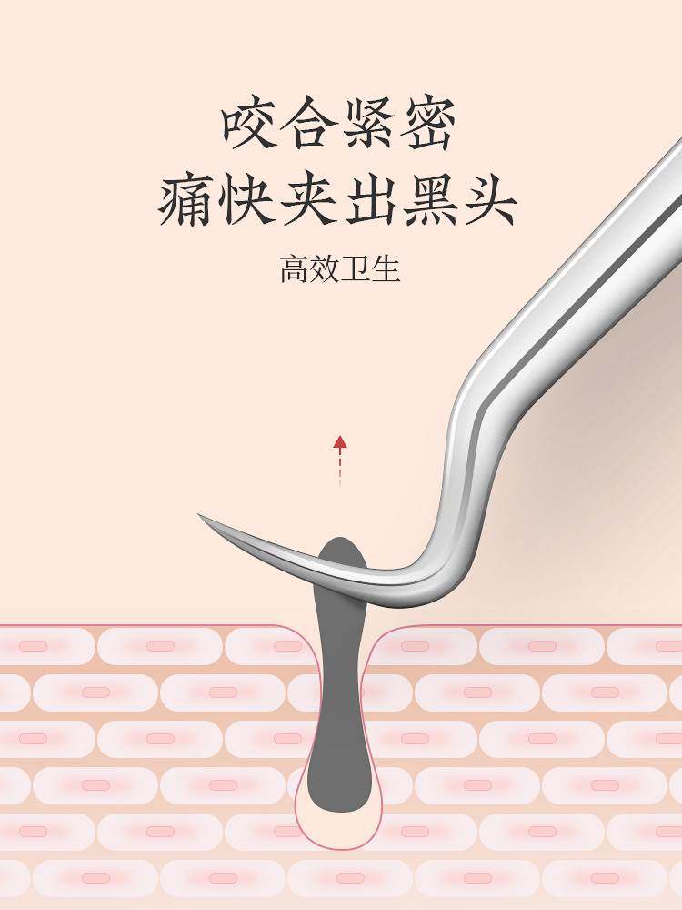 张小泉黑头夹镊子斜嘴细胞夹粉刺针挤痘痘工具尖头弯钩拔黑头夹子