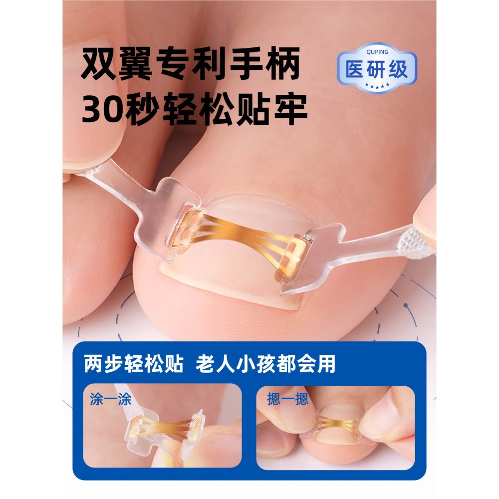曲平正甲甲沟嵌甲指甲矫正器炎正甲贴片医生脚趾甲盖扎肉足科专用
