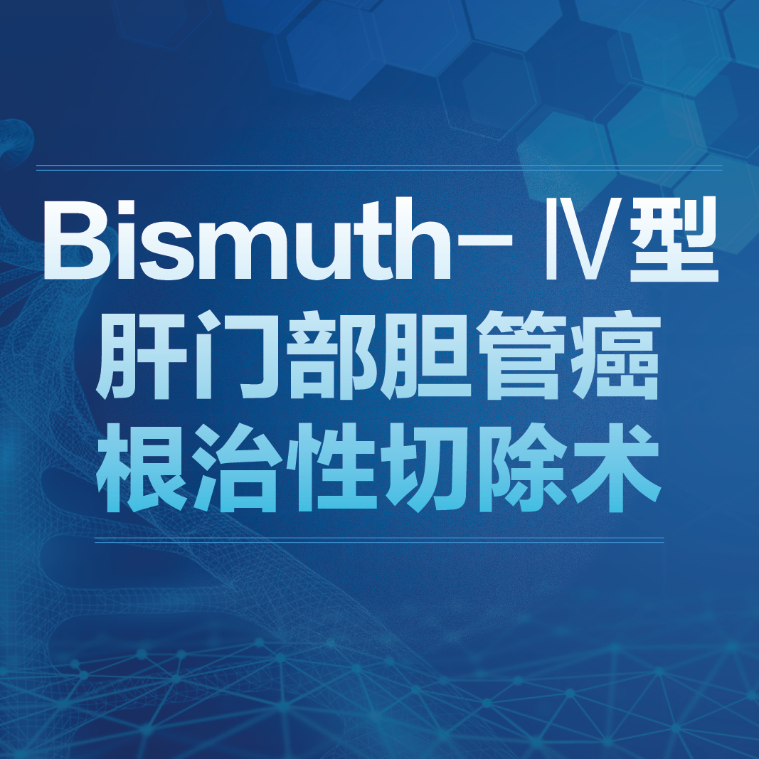 Bismuth-Ⅳ型肝门部胆管ai根治性切除术蔡守旺人卫慕课