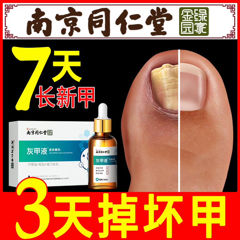 治疗灰指甲专用药去除增厚抑菌液软甲膏灰甲净日本正品脚趾外用