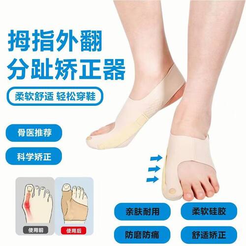 脚趾内外翻矫正器儿童大拇指食指