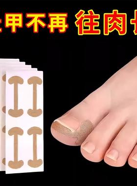 Self-adhesive elastic toe nail correction sticker, nail repa