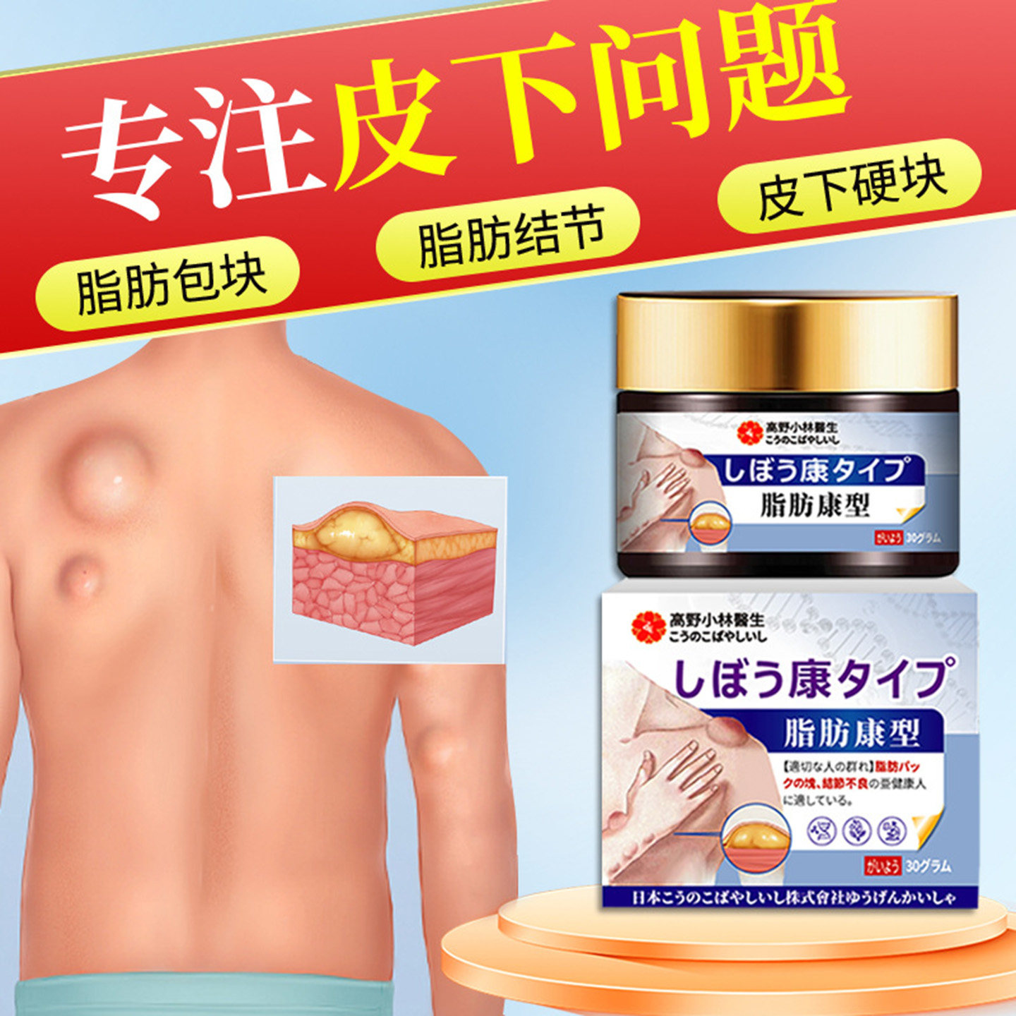 高野小林翳生脂肪包消除膏皮下结节硬块肿块鼓包疙瘩凸起皮抑菌膏