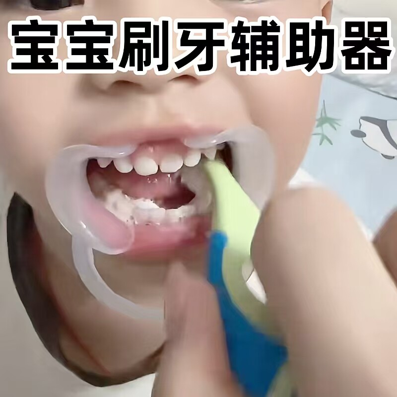 宝宝刷牙辅助器口腔清洁扩展器防咬嘴巴扩张开口儿童刷牙助手神器
