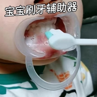 宝宝刷牙辅助器口腔清洁扩展器防咬嘴巴扩张开口儿童刷牙助手神器