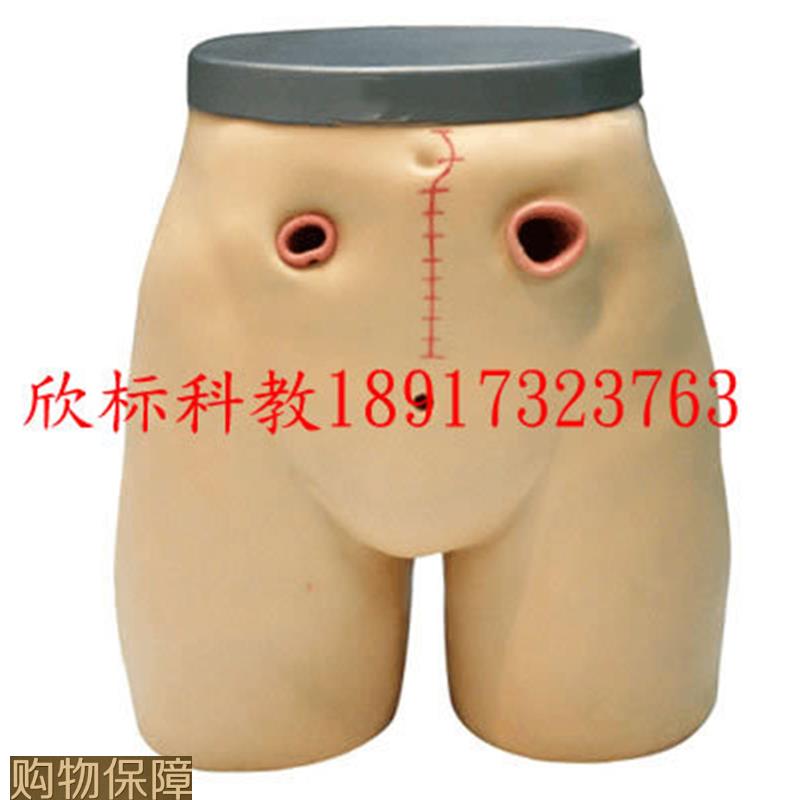 高级瘘管造口术护理模型造瘘术护理模型回肠造瘘模型结肠造口模型
