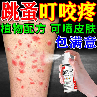 驱跳蚤特效药虫卵双杀阴虱咬专用止强效痒喷雾人用神器一扫光正品