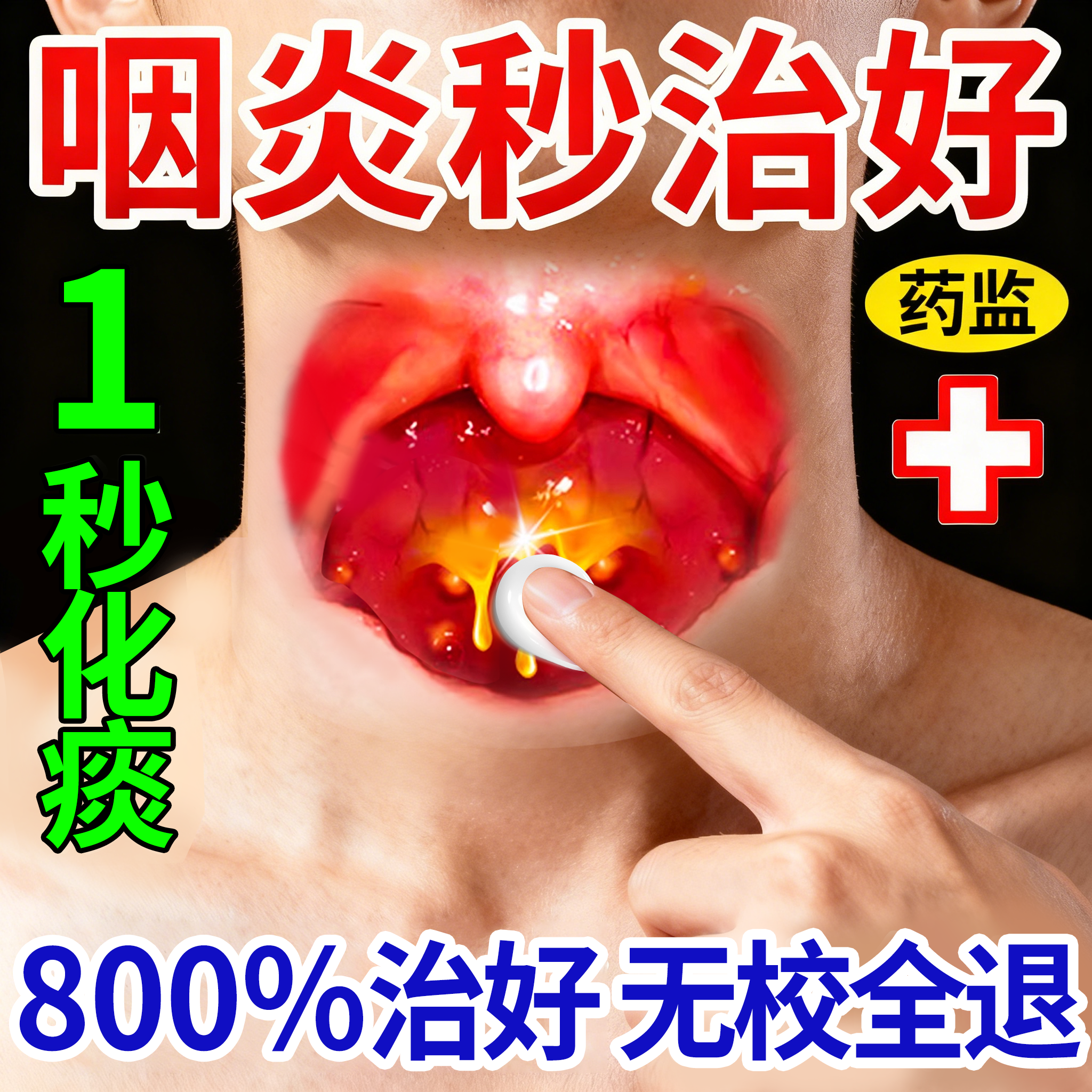 咽炎慢性咽喉炎异物感除咳嗽嗓子有痰根滤泡增生特效膏药专用喷雾