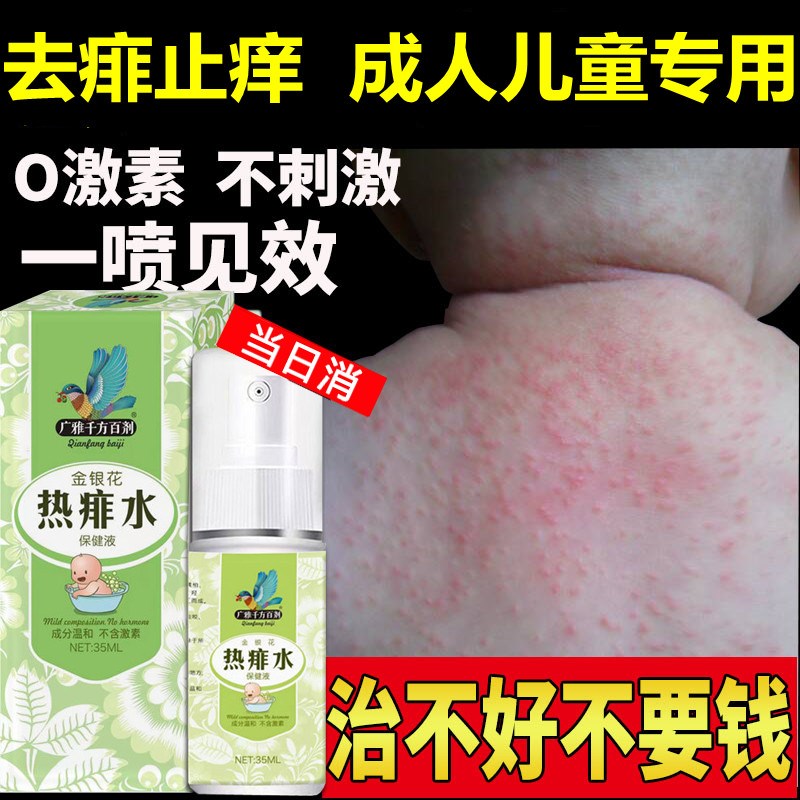 痱子止痒水成人去痱子喷雾液体祛痱膏治除热痱子水大人防菲神器药