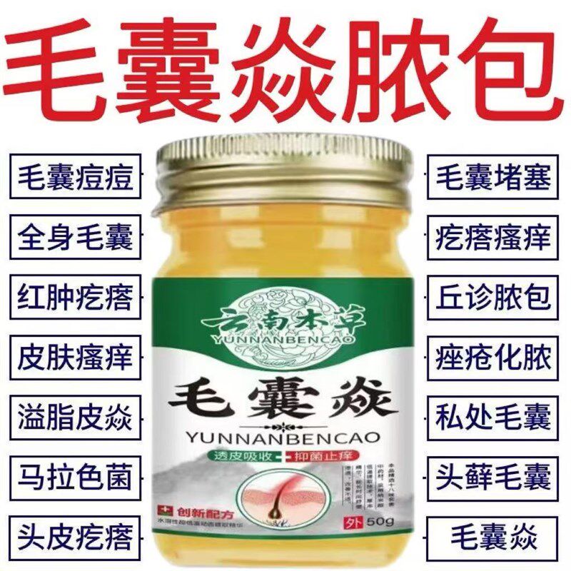 【毛囊炎药膏】正品头皮部脸部背部胸部毛囊痘脓包痤疮皮肤痒抑菌