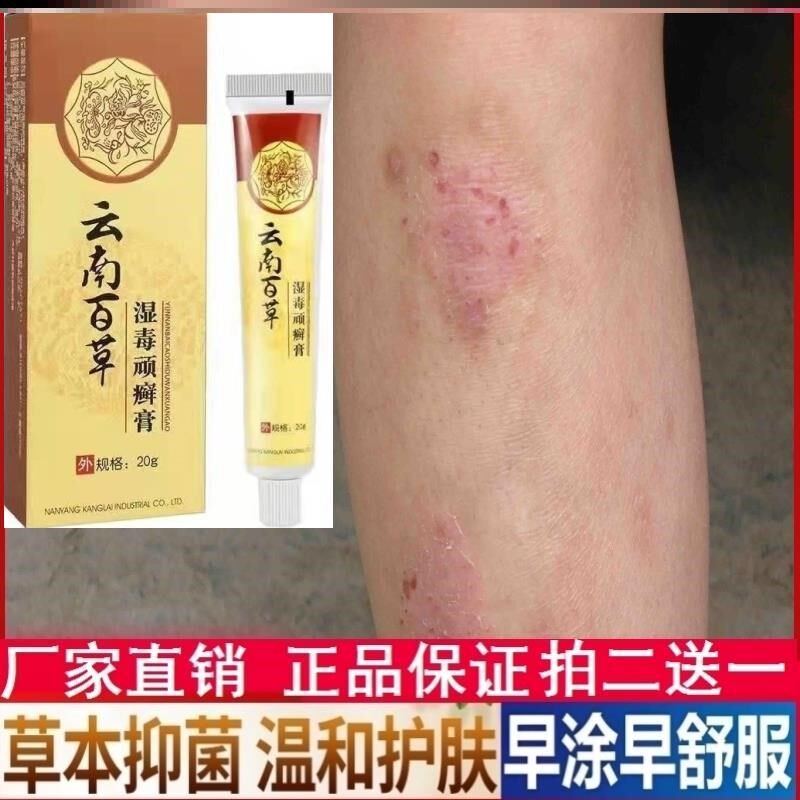 耳朵真菌感染外耳道皮屑干燥起皮流脓结痂霉菌性耳道炎