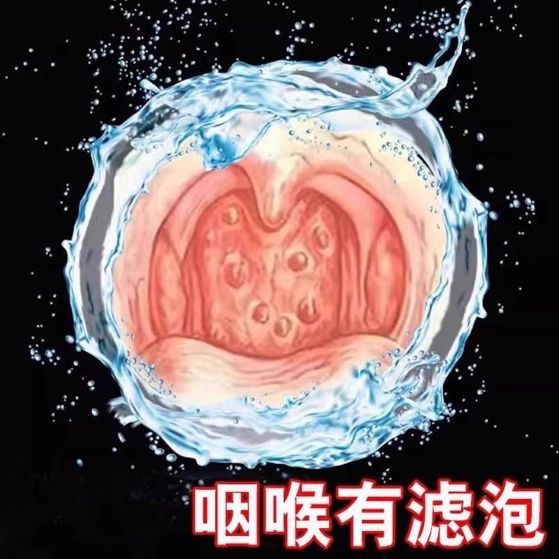 随喷随妤】喉咙滤泡增生咽喉焱淋巴滤泡舌根滤泡干痒咳嗽有异物感