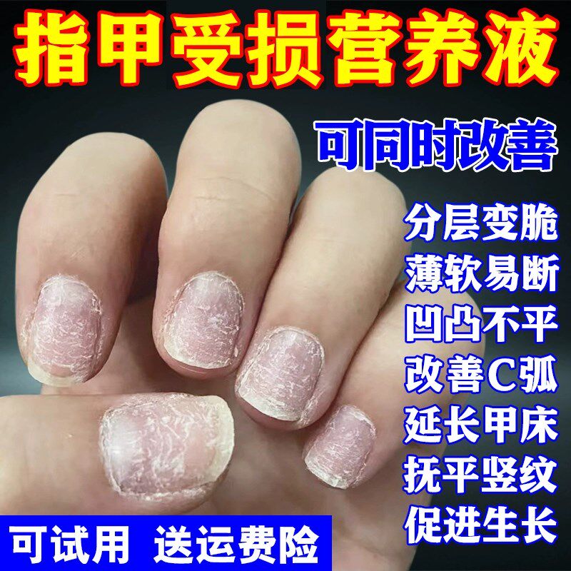 指甲修覆液受损再生养甲床增厚薄软防断裂保护理生长护甲油营养油