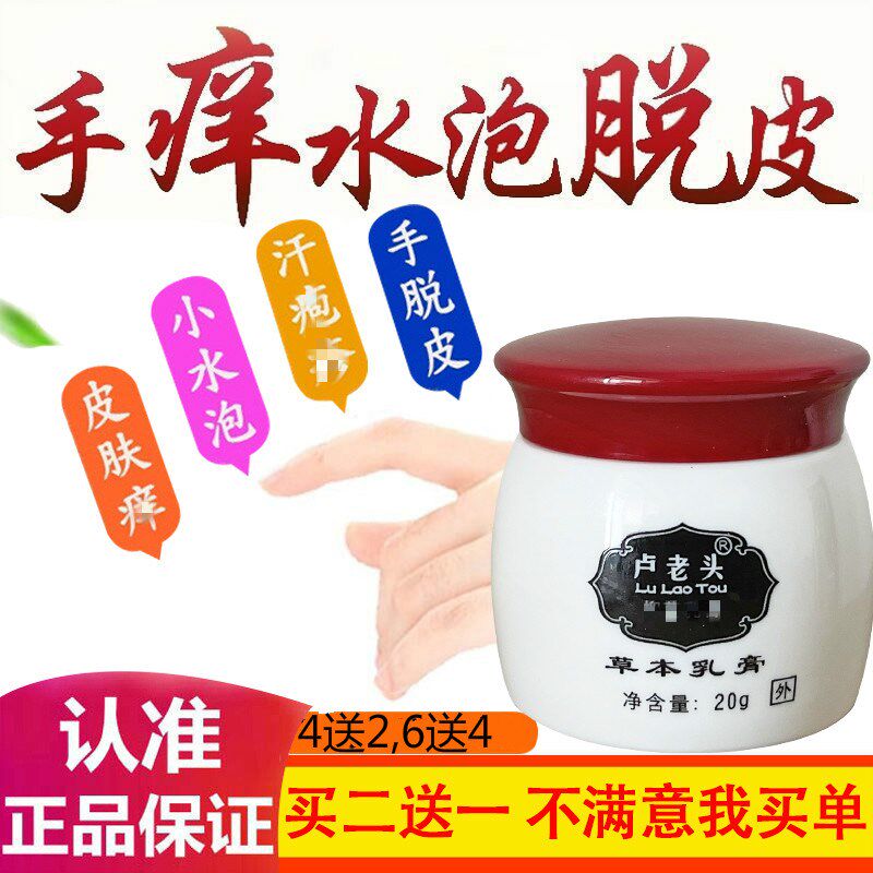卢老头草本乳膏手脱皮手痒起小水泡型脚底起皮手痒脚开裂干燥过敏