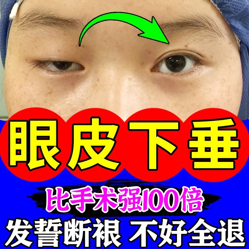 上眼皮下垂提拉眼贴老年人双眼皮松弛提拉紧致专用大小眼矫正神器