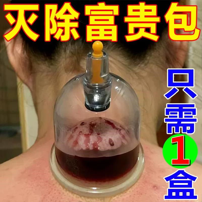 【包痊愈】富贵包消除神器修复颈部大椎鼓包肩颈脖子酸痛堵塞祛包