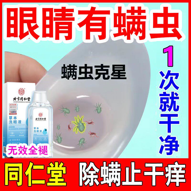 治疗眼睛螨虫洗眼液干痒杀除螨湿巾清洁眼水眼贴眼睑滴眼部专用