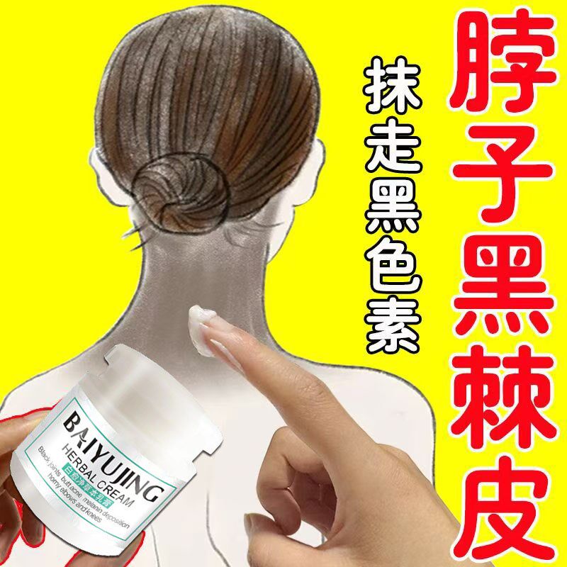 黑色素沉淀腋下胳膊肘脚踝白愈腚关节黑洗不净脖子黑颈部膝盖私处