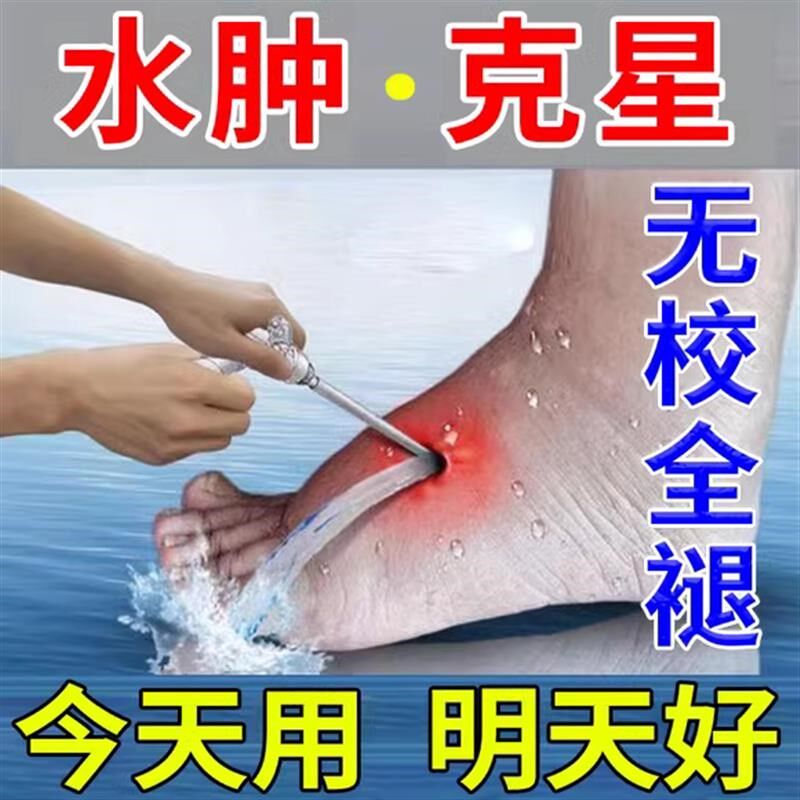 200%消水肿脚肿去浮肿消水肿神器浮肿腿肿利尿老人腿脚水肿专用