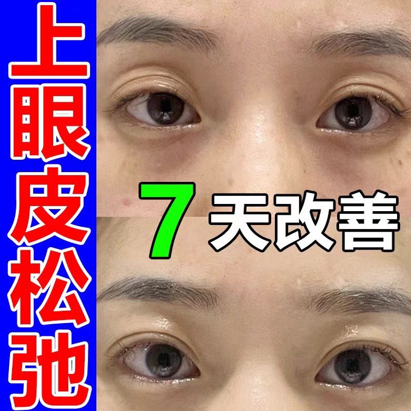 眼皮下垂提拉眼贴上眼皮松弛提拉紧致三眼皮大小眼矫正贴专用神器