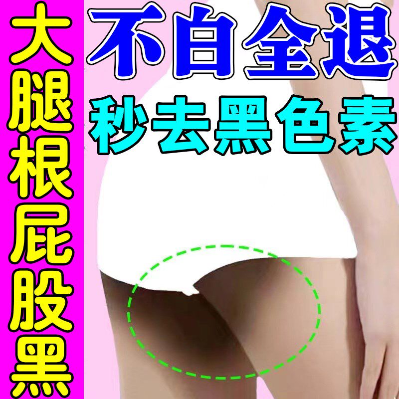 大腿内侧黑色素沉淀去除屁股黑去黑坐印大腿两侧发黑私处褪黑变白